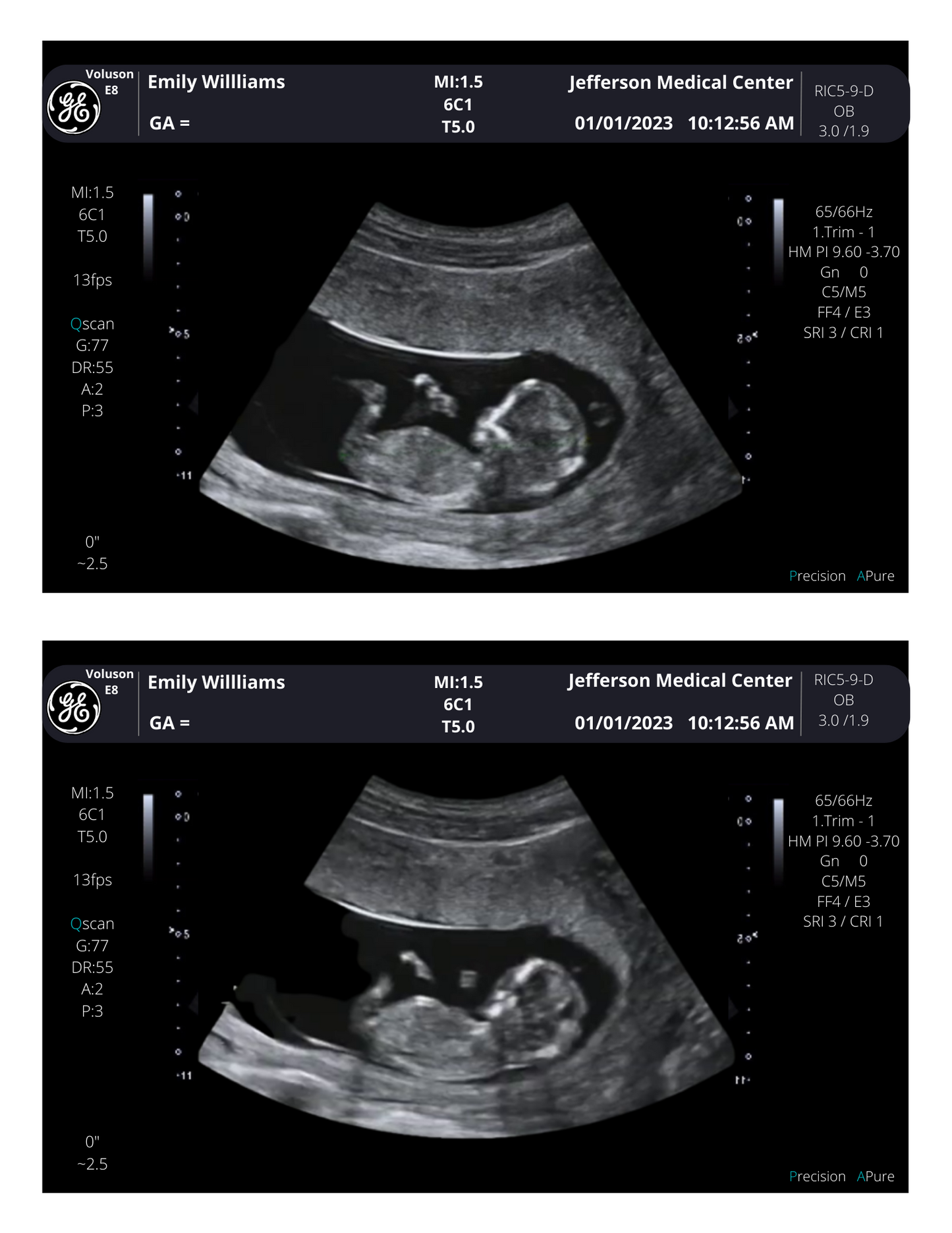 PRINTED & SHIPPED!!  Customizable Sonogram Picture | Personalized Fake Ultrasound Picture |