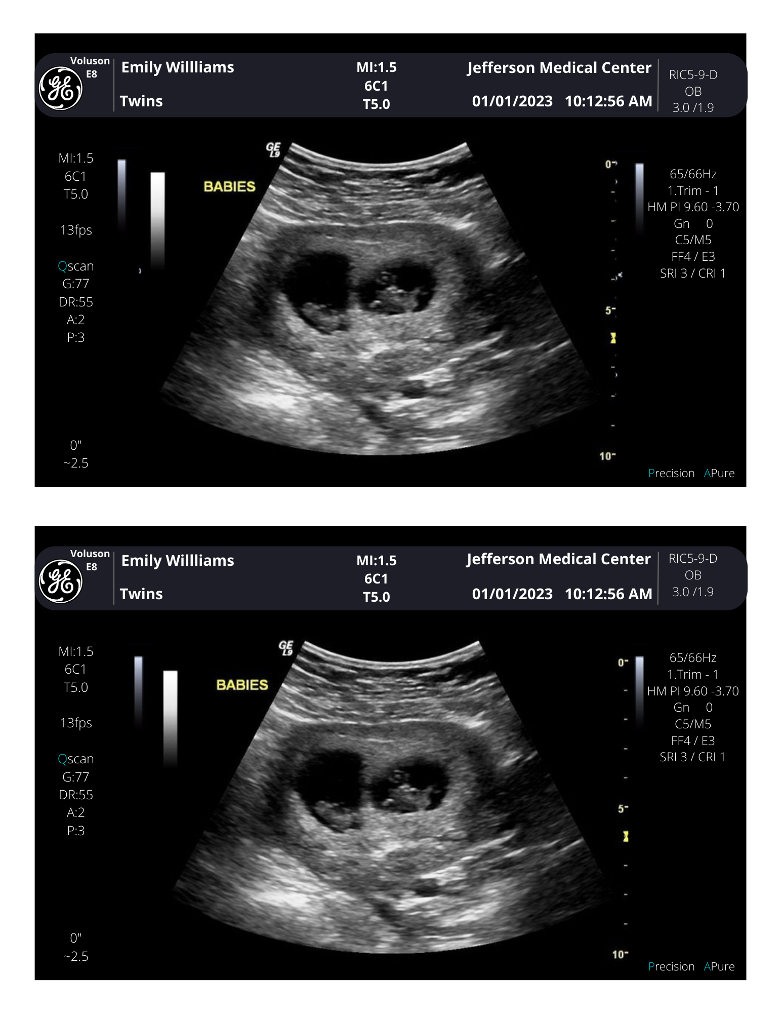 Personalized Fake Ultrasound Sonogram Picture!! From 340 weeks! creetify