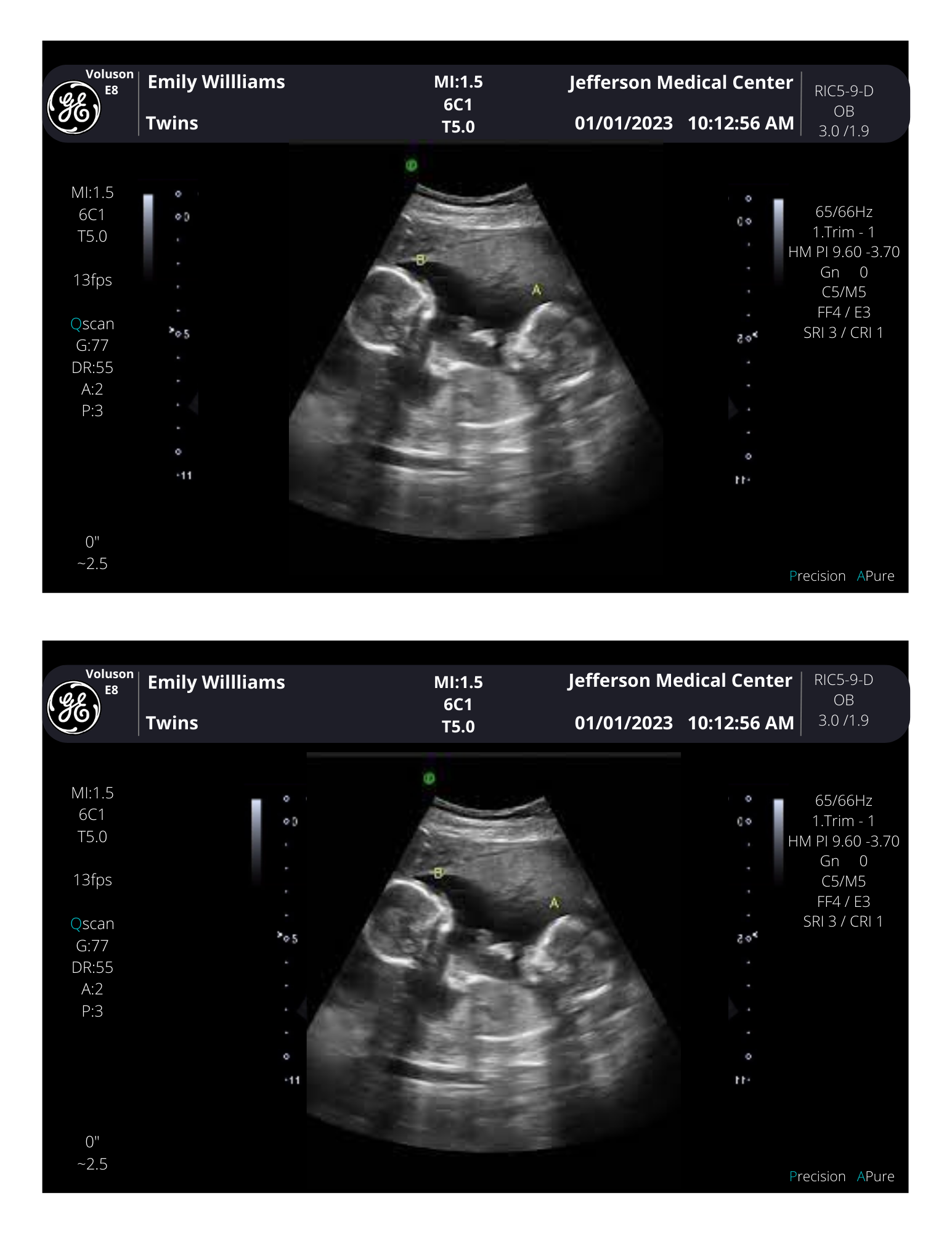 PRINTED & SHIPPED! Personalized Fake Ultrasound Scan | Customizable So ...