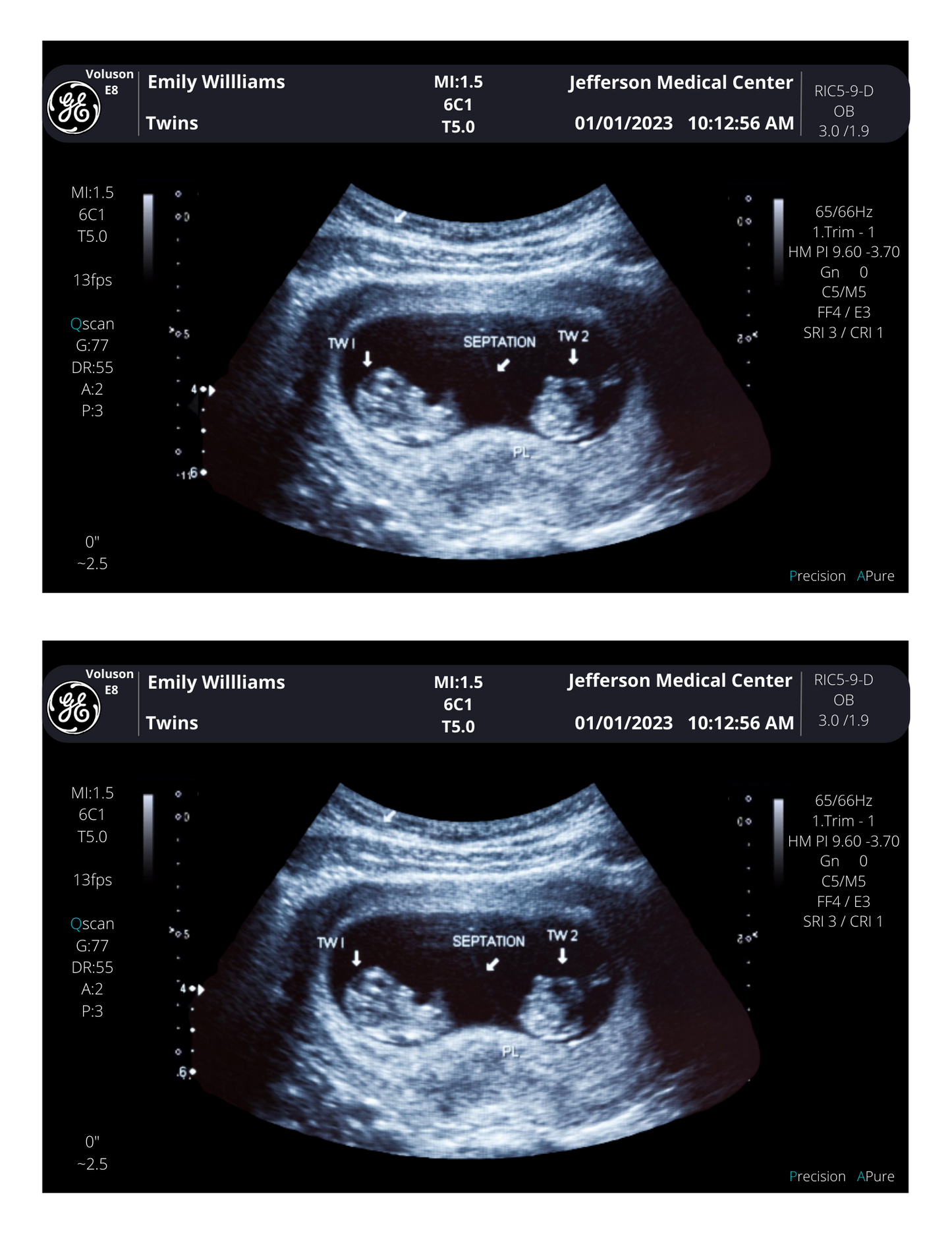 Customizable Digital Ultrasound Downloads | Fake Sonogram Picture |