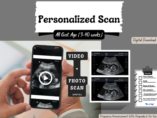 Fake Ultrasound Video Plus Picture!! Instant Download | All Gestation Weeks (4-40 weeks) |