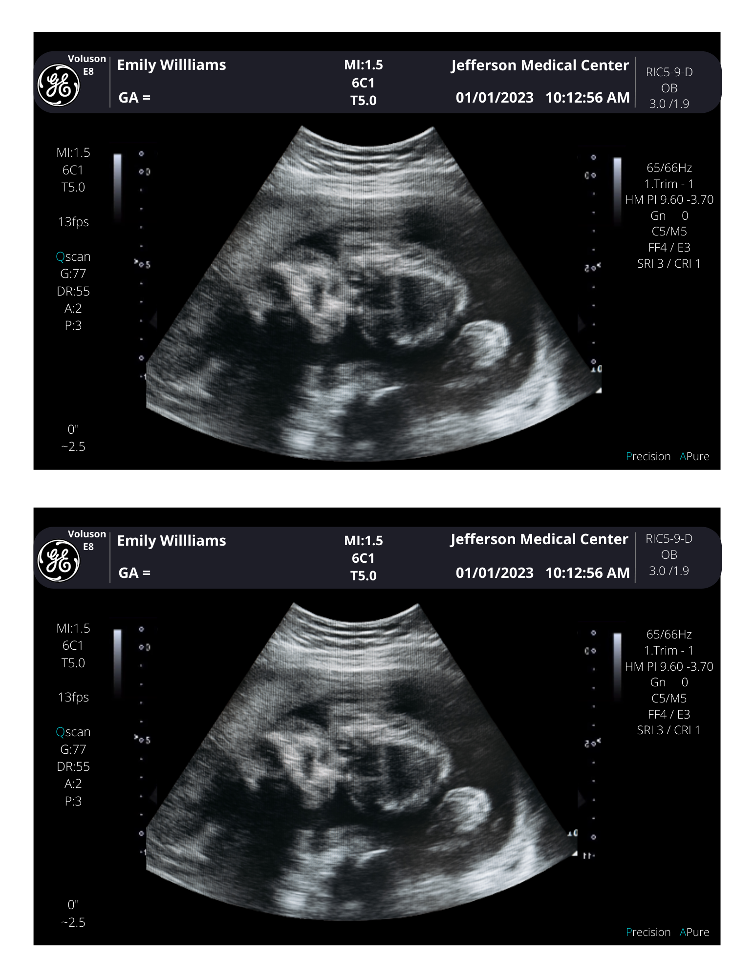 Personalized Fake Ultrasound Sonogram Picture!! From 340 weeks! creetify