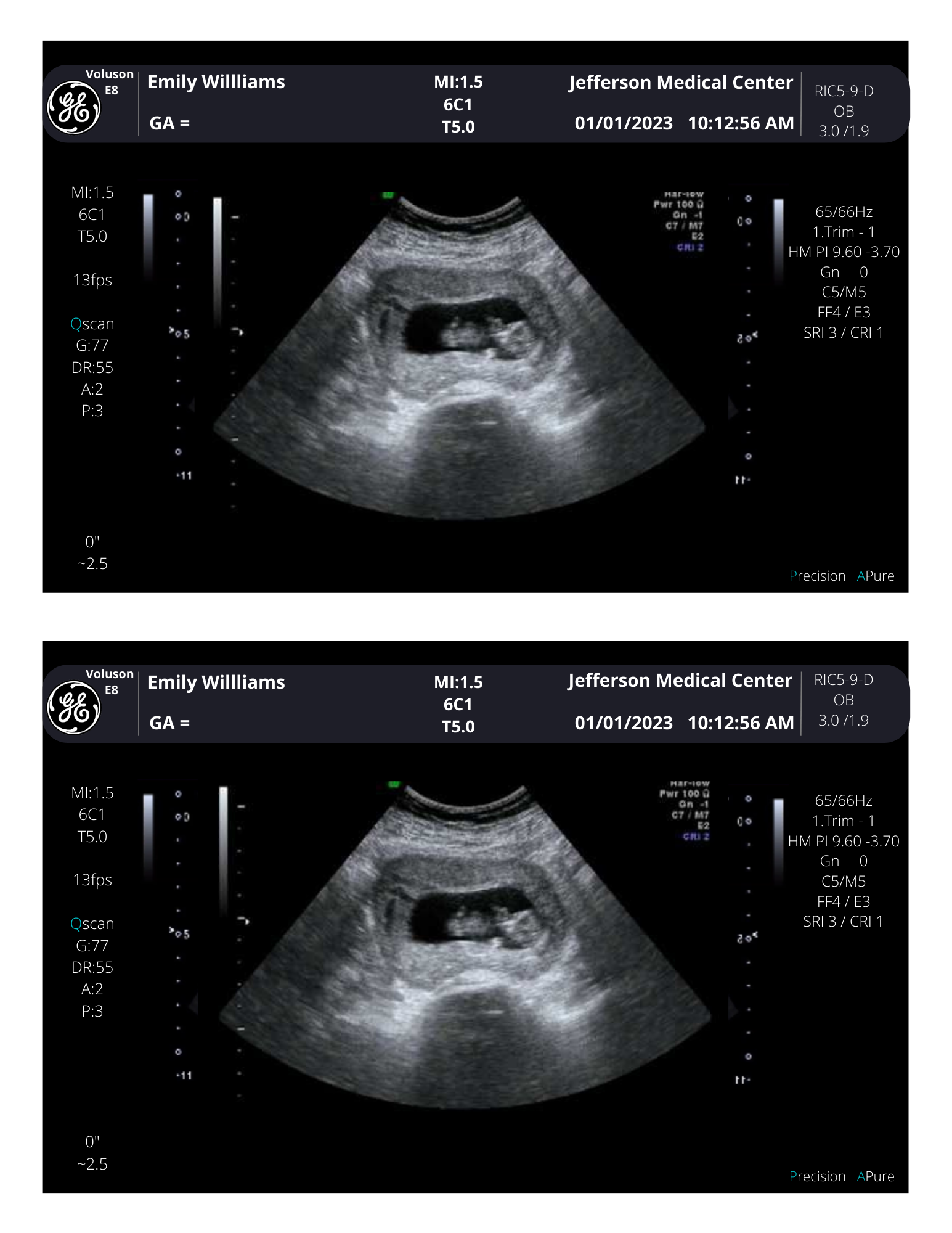 PRINTED & SHIPPED!! Customizable Sonogram Picture Personalized Fake