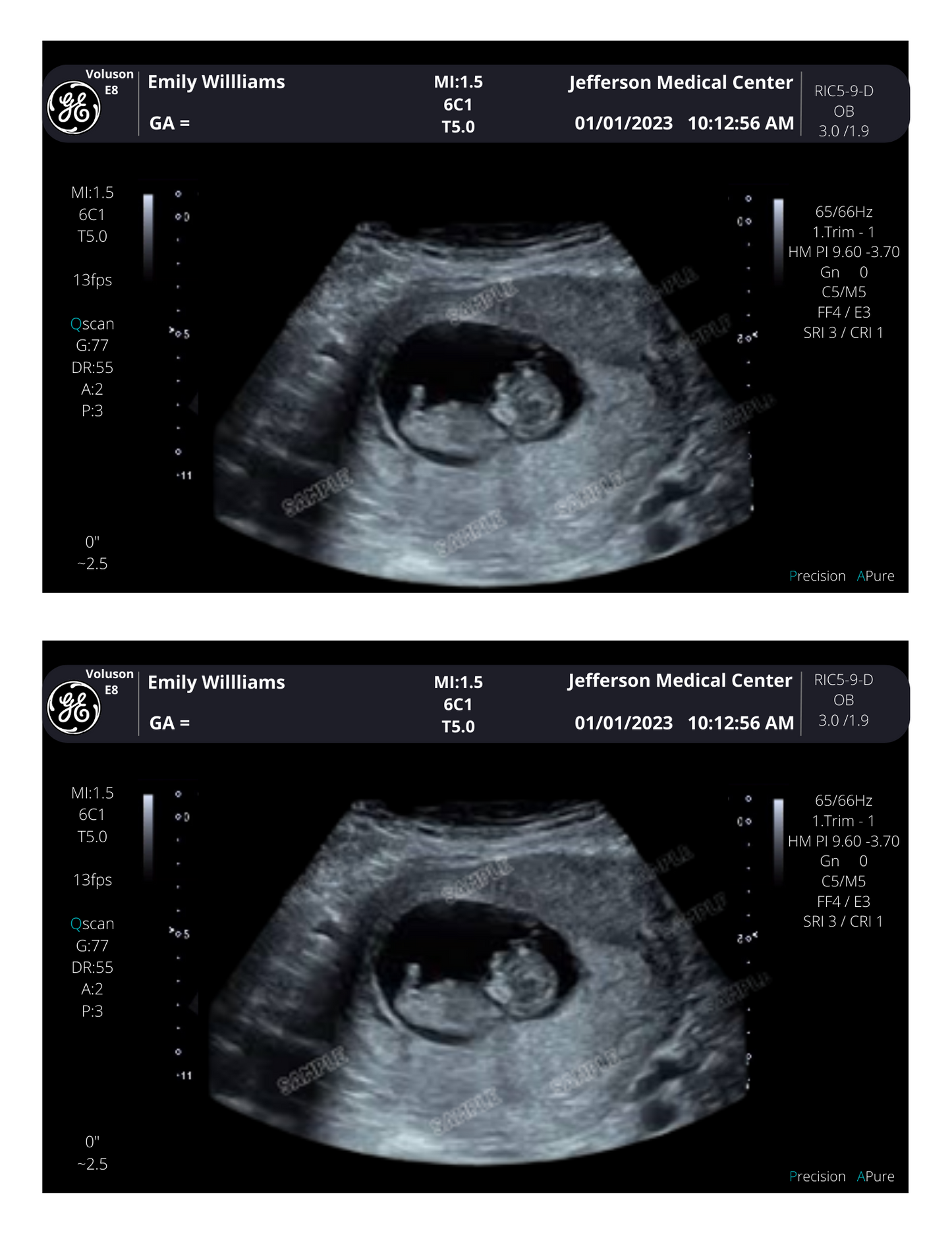 On SALE!! Fake Ultrasound Picture | INSTANT DOWNLOAD!! Customized Digital Sonogram Picture |