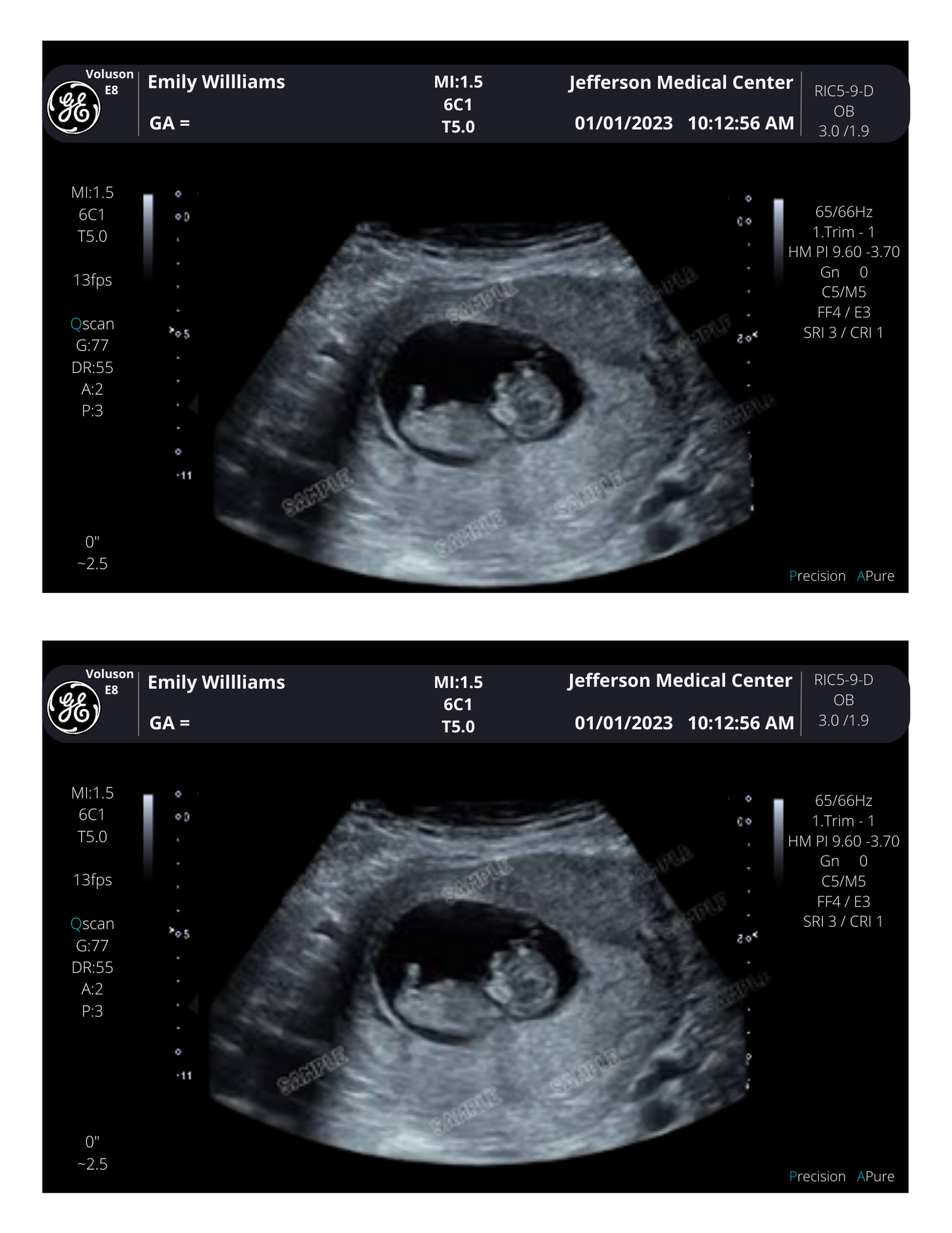 Customizable Digital Ultrasound Downloads | Fake Sonogram Picture |