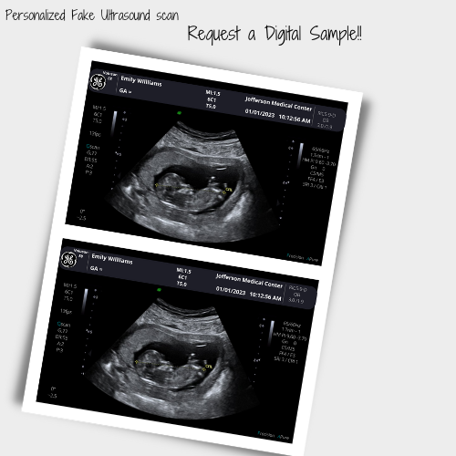 PNG Formats Customizable Digital Ultrasound Downloads | Fake Sonogram Picture |